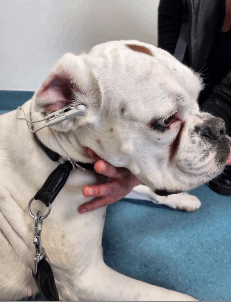 vagusstimulation am Ohr